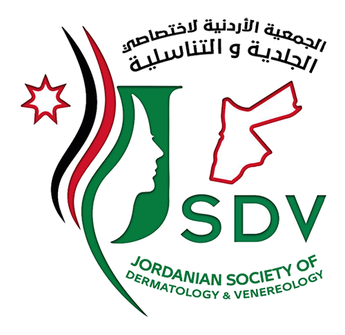JSDV