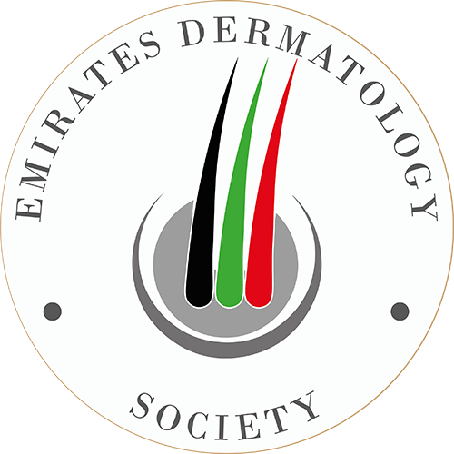 EDS